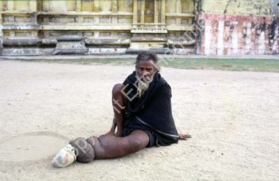 Ekambareshvara temple beggar elephantiasis Kanchipuram 854118