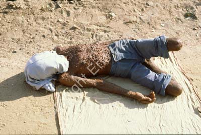 Leprosy man on ground 827003