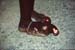 Man with elephantiasis foot 826814
